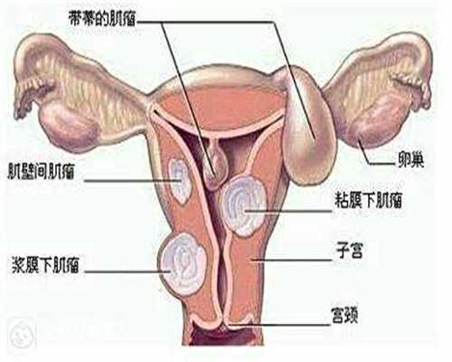 南京供卵生子：科学规划助你少走弯路